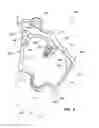 Fig. 03 - Cheek retractor device and method