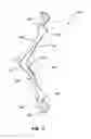 Fig. 04 - Cheek retractor device and method