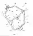 Fig. 05 - Cheek retractor device and method
