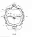 Fig. 06 - Cheek retractor device and method