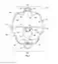 Fig. 07 - Cheek retractor device and method