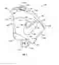 Fig. 08 - Cheek retractor device and method