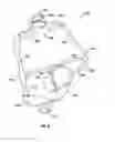 Fig. 10 - Cheek retractor device and method