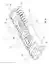 Fig. 11 - Rapid palatal expander and method for the assembly thereof