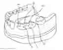 Fig. 01 - DENTAL IMPLANT SYSTEM AND METHOD OF USE