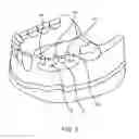 Fig. 04 - DENTAL IMPLANT SYSTEM AND METHOD OF USE