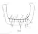 Fig. 06 - DENTAL IMPLANT SYSTEM AND METHOD OF USE