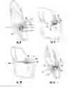 Fig. 06 - A DENTAL IMPLANT