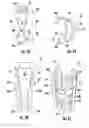 Fig. 10 - A DENTAL IMPLANT
