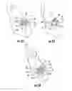 Fig. 11 - A DENTAL IMPLANT
