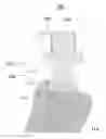 Fig. 01 - Fixed hybrid dental attachment device and methods of use