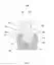 Fig. 02 - Fixed hybrid dental attachment device and methods of use
