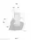 Fig. 06 - Fixed hybrid dental attachment device and methods of use