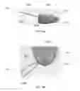 Fig. 19 - Fixed hybrid dental attachment device and methods of use