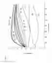 Fig. 04 - Prosthesis