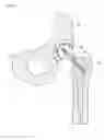 Fig. 07 - Prosthesis