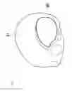 Fig. 12 - Prosthesis