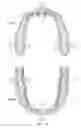 Fig. 10 - Fastenable device for oral cavity position detection