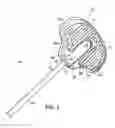 Fig. 03 - Systems, methods and devices relating to delivery of medical implants
