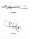 Fig. 35 - Systems, methods and devices relating to delivery of medical implants