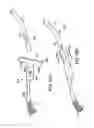 Fig. 51 - Systems, methods and devices relating to delivery of medical implants