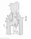Fig. 58 - Systems, methods and devices relating to delivery of medical implants