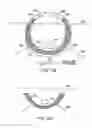 Fig. 72 - Systems, methods and devices relating to delivery of medical implants