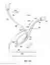Fig. 73 - Systems, methods and devices relating to delivery of medical implants