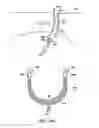 Fig. 77 - Systems, methods and devices relating to delivery of medical implants