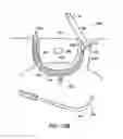 Fig. 80 - Systems, methods and devices relating to delivery of medical implants