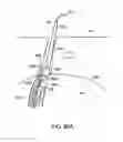 Fig. 81 - Systems, methods and devices relating to delivery of medical implants