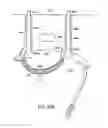 Fig. 82 - Systems, methods and devices relating to delivery of medical implants