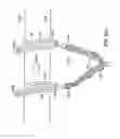 Fig. 88 - Systems, methods and devices relating to delivery of medical implants
