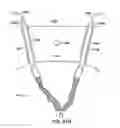 Fig. 93 - Systems, methods and devices relating to delivery of medical implants
