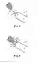 Fig. 02 - Implants, tools, and methods for treating pelvic conditions