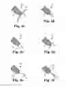 Fig. 03 - Implants, tools, and methods for treating pelvic conditions