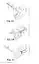 Fig. 06 - Implants, tools, and methods for treating pelvic conditions
