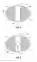 Fig. 03 - Implant for parastomal hernia