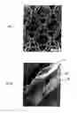 Fig. 05 - Implant for parastomal hernia