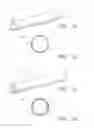 Fig. 02 - Prosthetic Vascular Conduits for Cardiovascular Structures