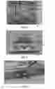 Fig. 03 - Decellularization method and system and decellularized tissue formed thereby