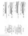 Fig. 12 - Endoluminal prosthesis having multiple branches or fenestrations and methods of deployment