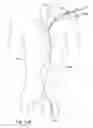 Fig. 15 - Endoluminal prosthesis having multiple branches or fenestrations and methods of deployment