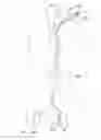 Fig. 16 - Endoluminal prosthesis having multiple branches or fenestrations and methods of deployment