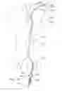 Fig. 18 - Endoluminal prosthesis having multiple branches or fenestrations and methods of deployment