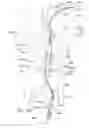 Fig. 20 - Endoluminal prosthesis having multiple branches or fenestrations and methods of deployment