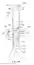 Fig. 29 - Endoluminal prosthesis having multiple branches or fenestrations and methods of deployment