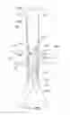 Fig. 34 - Endoluminal prosthesis having multiple branches or fenestrations and methods of deployment