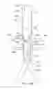 Fig. 35 - Endoluminal prosthesis having multiple branches or fenestrations and methods of deployment