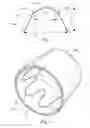 Fig. 06 - Low profile non-symmetrical stent